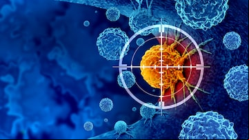 Cancer detection and screening as a treatment for malignant cells with a biopsy or testing caused by carcinogens and genetics with a cancerous cell as an immunotherapy symbol as a 3D render. Foto: freshidea/Adobe Stock